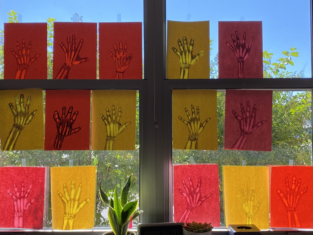 4th Grade Hand X-Rays